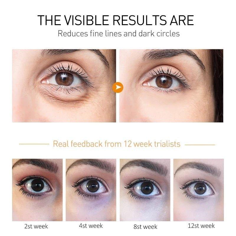 EyeLift™ | Voor een jeugdige oogopslag