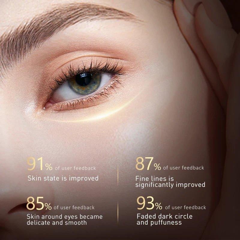 EyeLift™ | Voor een jeugdige oogopslag