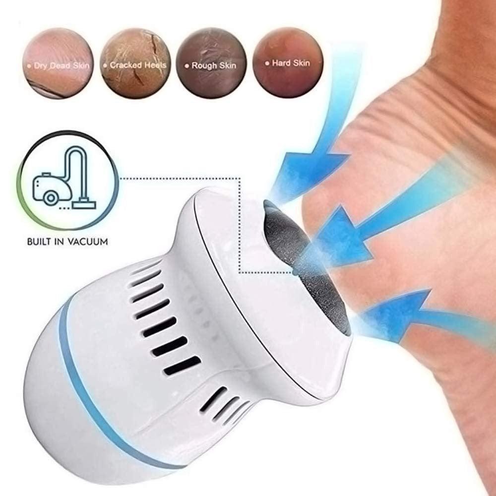 SmoothFeet™ | transformeer uw pedicure routine