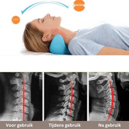 RelaxoFlex™ | De ultieme oplossing voor nekmassage