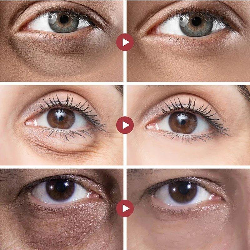 EyeLift™ | Voor een jeugdige oogopslag