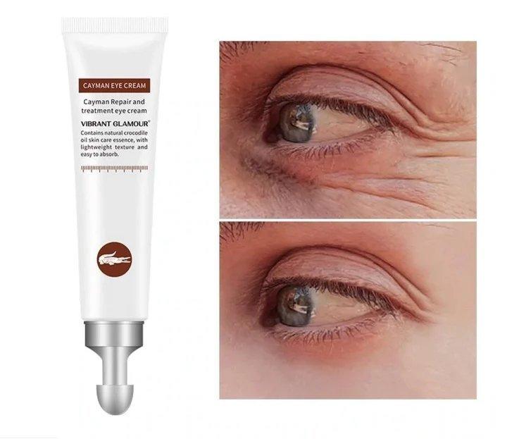 EyeLift™ | Voor een jeugdige oogopslag