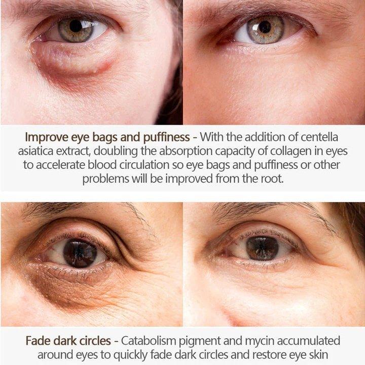 EyeLift™ | Voor een jeugdige oogopslag