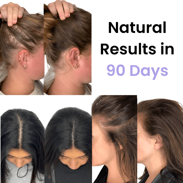 RevitalisHair™ | Stralend, gezond haar