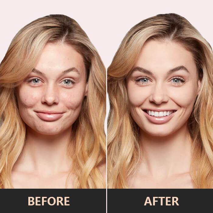 LumeShine™ | Direct stralend en zelfverzekerd